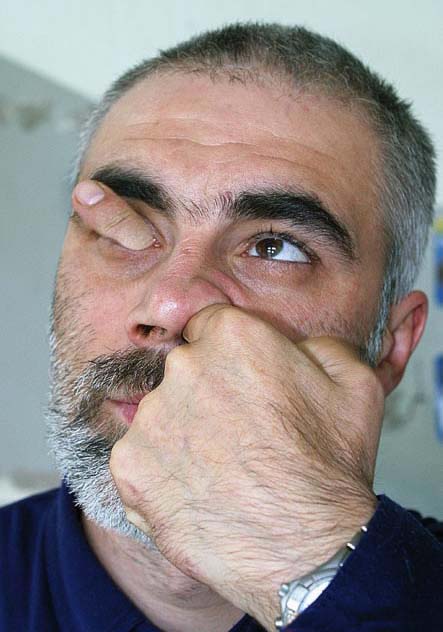 fingur  gegnum auga